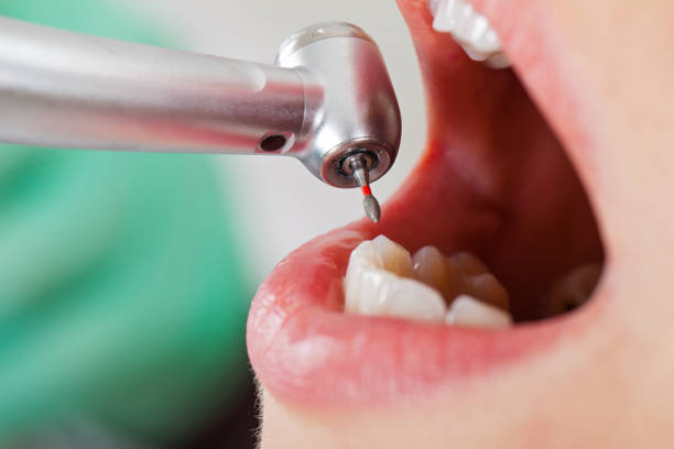 Best Urgent Dental Care for Toothaches in Felton, CA